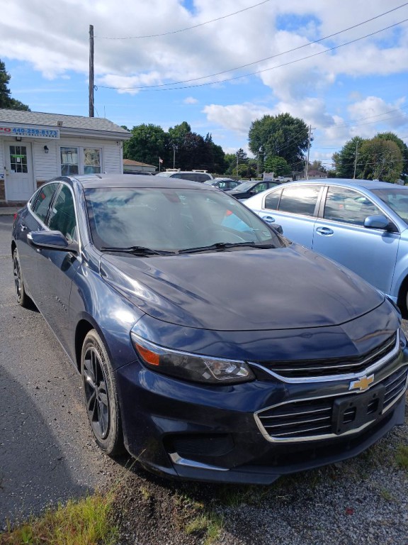 2017 Chevrolet Malibu Image 1