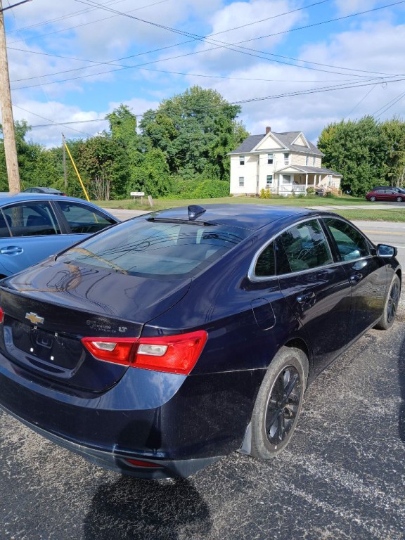 2017 Chevrolet Malibu Image 3