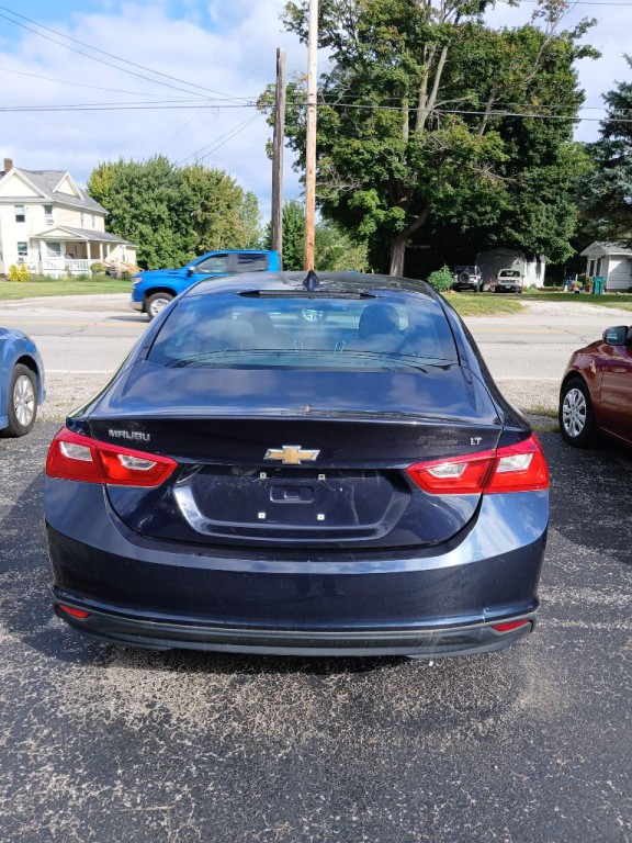 2017 Chevrolet Malibu Image 4