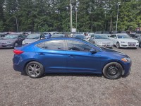 Image for 2017 Hyundai Elantra SE ID: 7453539