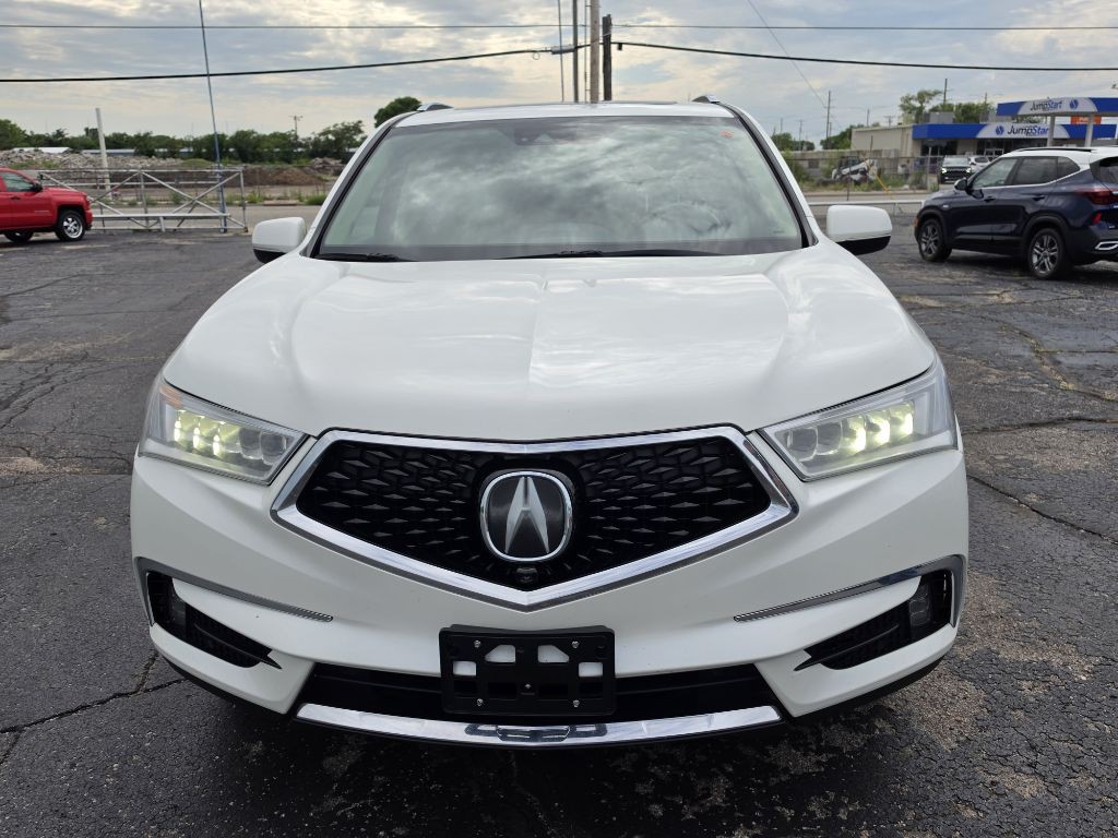 2017 Acura MDX Image 2