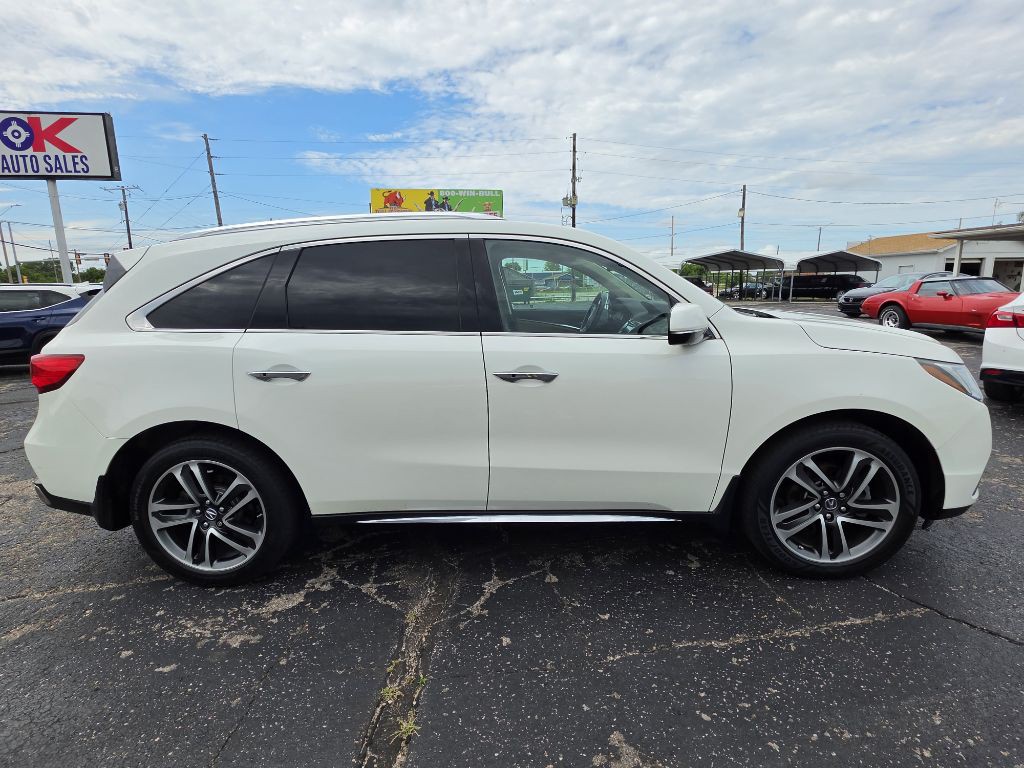 2017 Acura MDX Image 3
