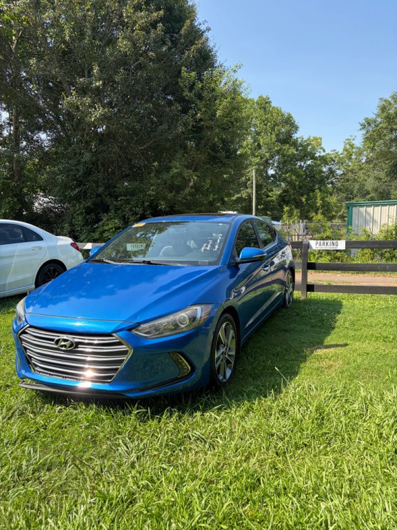2017 Hyundai Elantra Image 3