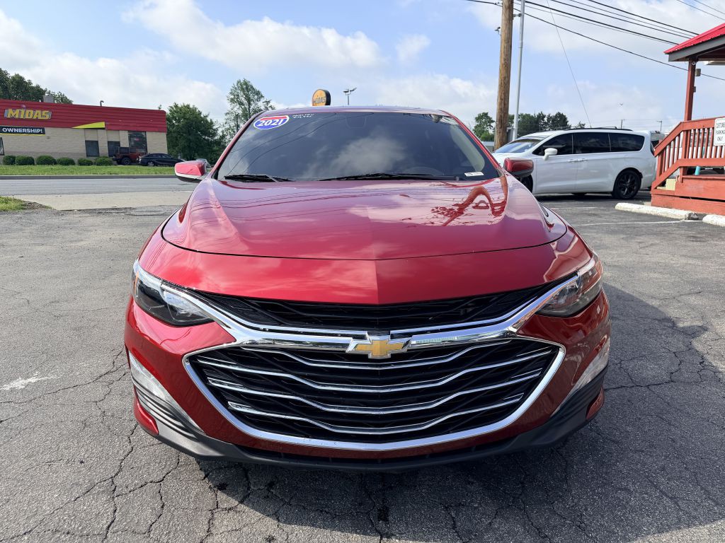 2021 Chevrolet Malibu Image 2