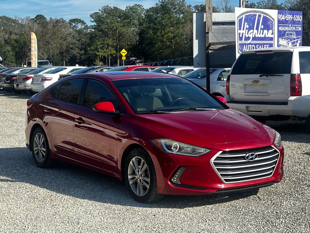 2017 Hyundai Elantra Image 1