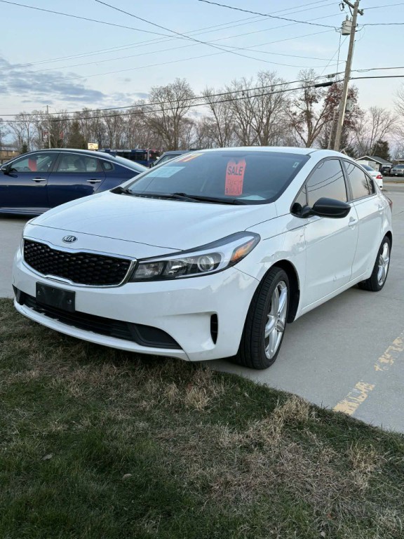 2017 Kia Forte Image 3