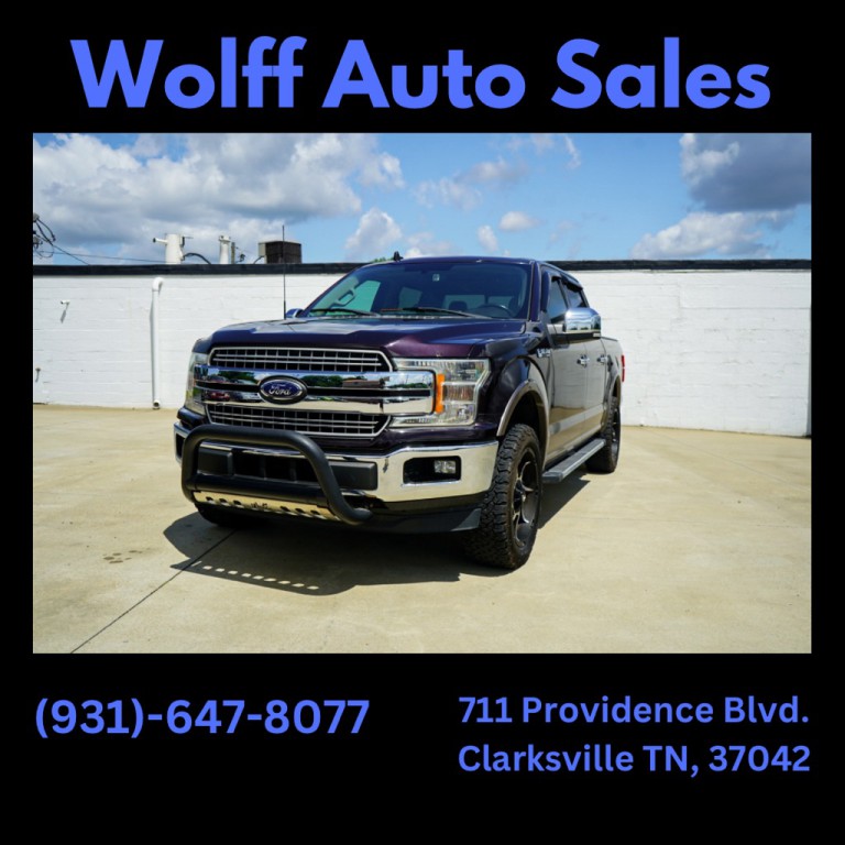 2018 Ford F-150 Image 1