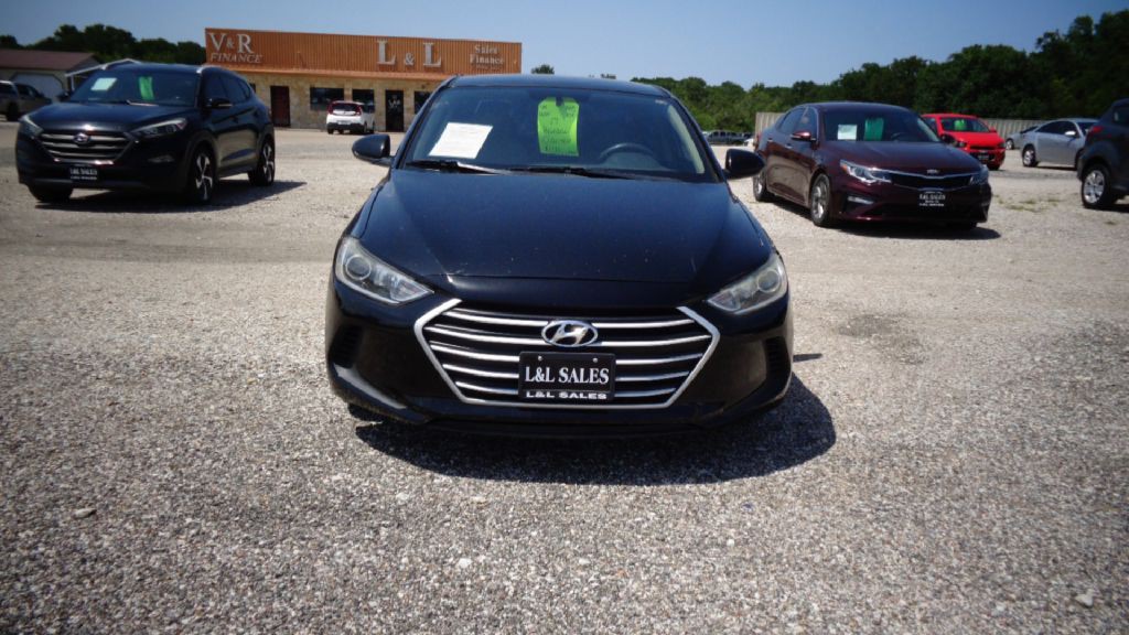 2017 Hyundai Elantra Image 2