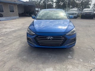 Image for 2017 Hyundai Elantra Sport ID: 7228822