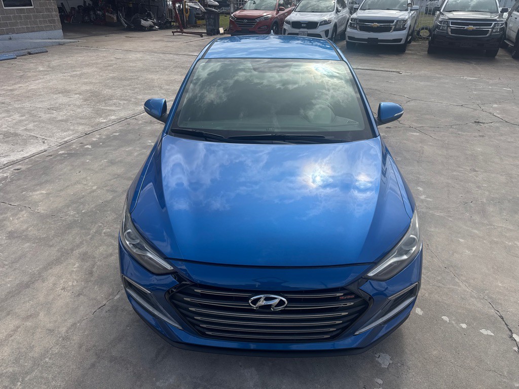 2017 Hyundai Elantra Image 2