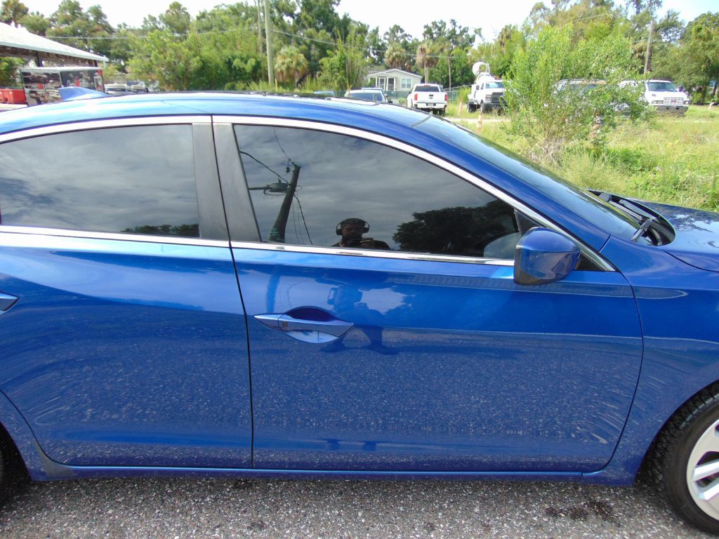 2017 Acura ILX Image 5