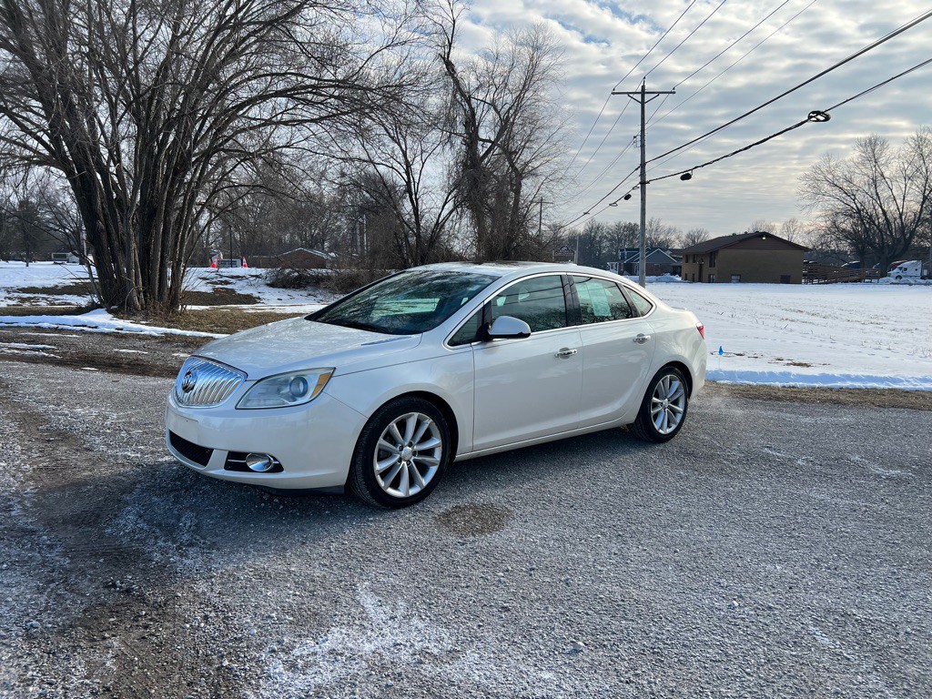 2016 Buick Verano Image 1