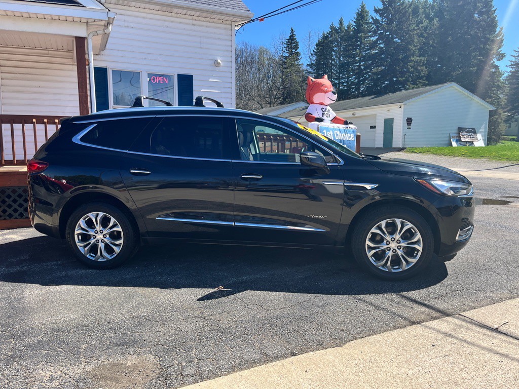2018 Buick Enclave Image 2