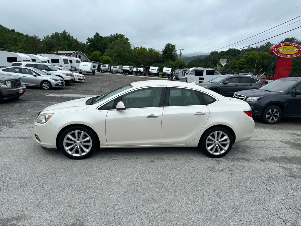 2014 Buick Verano Image 2