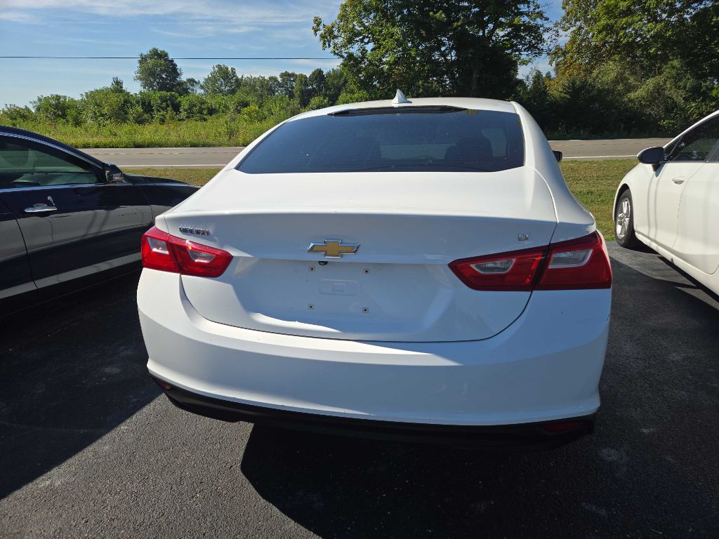 2016 Chevrolet Malibu Image 3