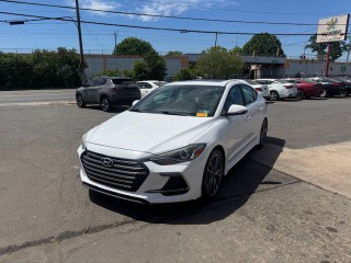 Image for 2018 Hyundai Elantra Sport ID: 7353252