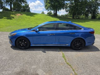 Image for 2018 Hyundai Sonata Sport ID: 7483873