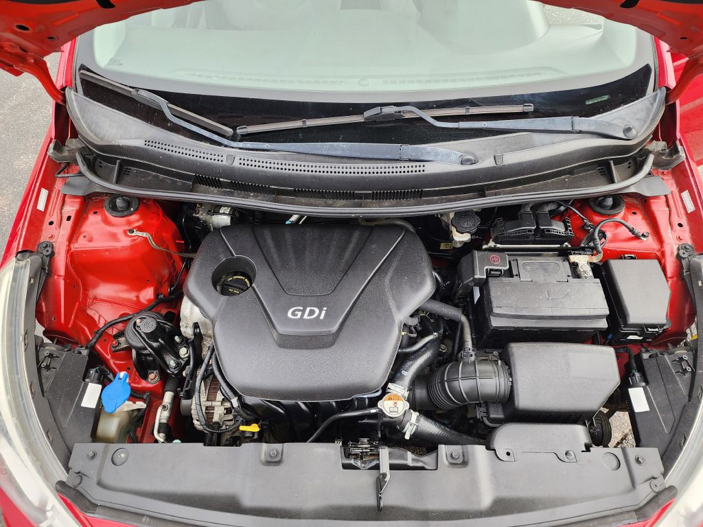 2017 Hyundai Accent Image 14