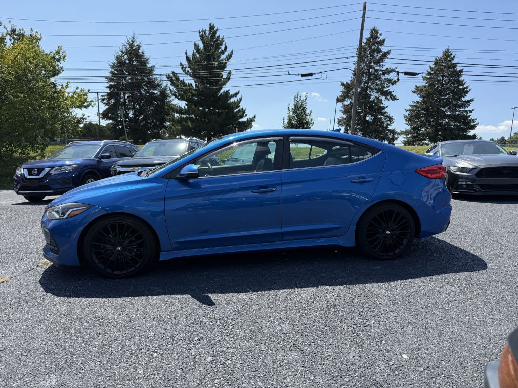 2017 Hyundai Elantra Image 2