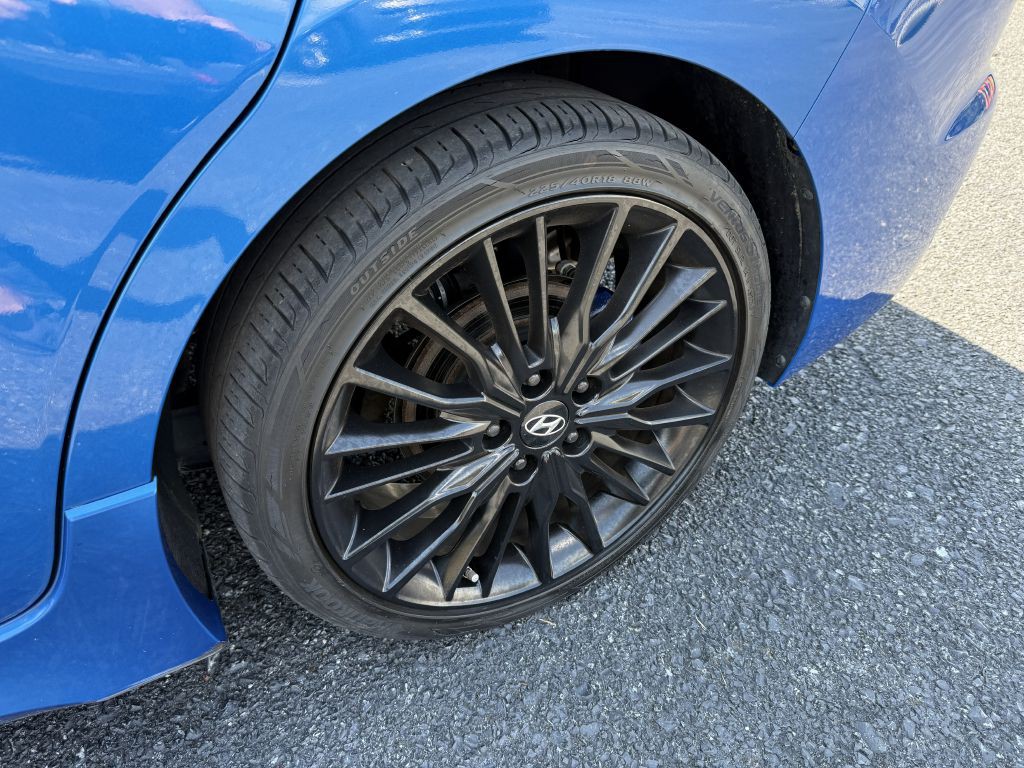 2017 Hyundai Elantra Image 10