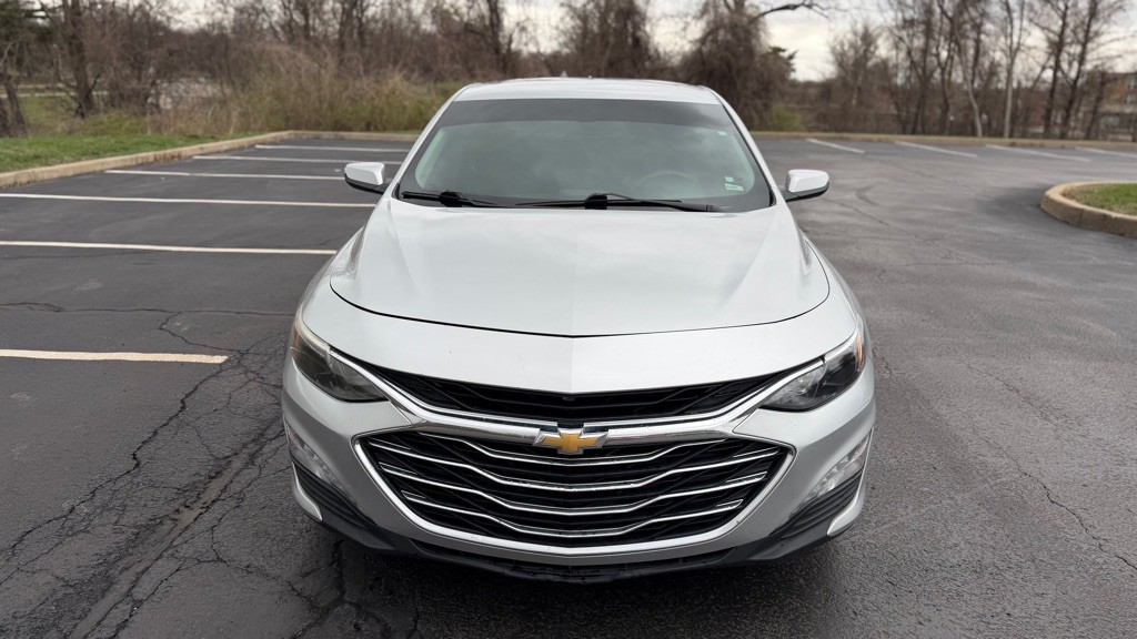 2017 Chevrolet Malibu Image 2