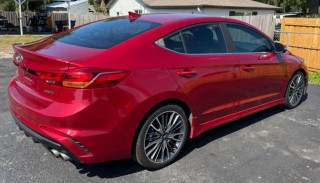 Image for 2017 Hyundai Elantra Sport ID: 6812722