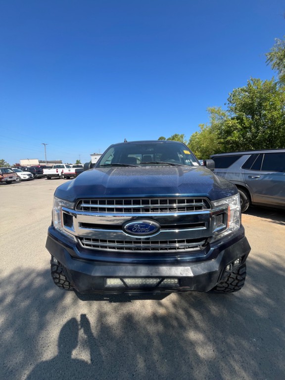 2018 Ford F-150 Image 2