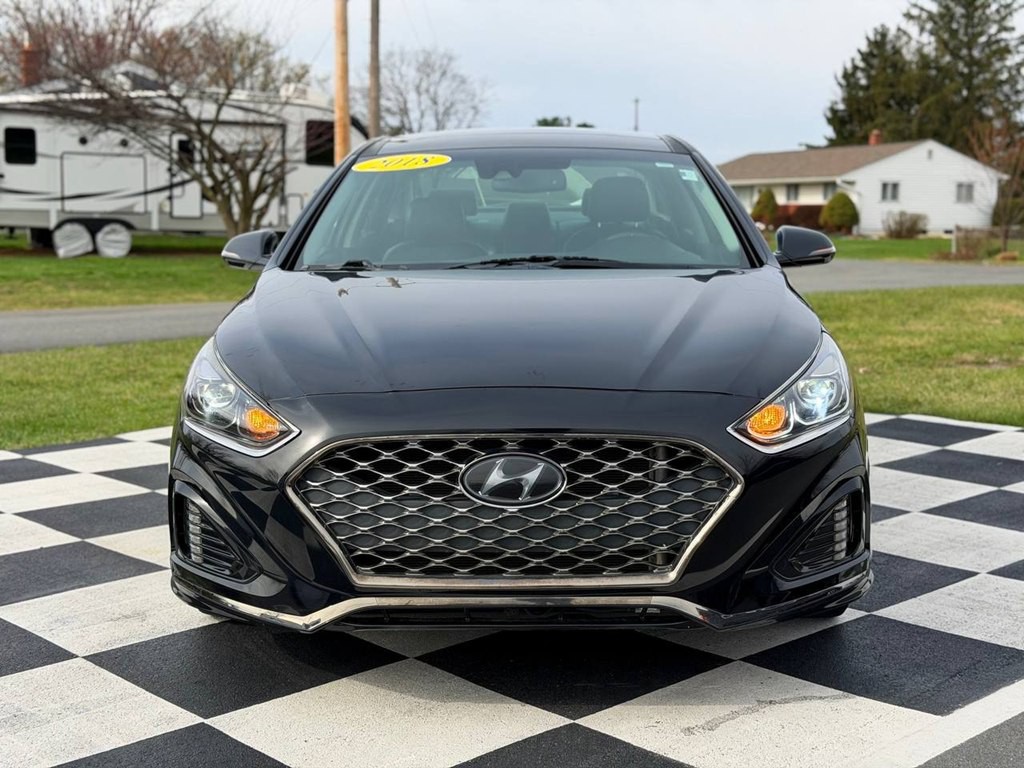 2018 Hyundai Sonata Image 3