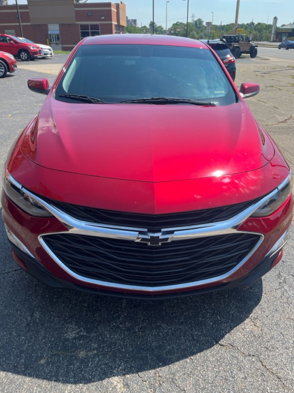 2021 Chevrolet Malibu Image 2