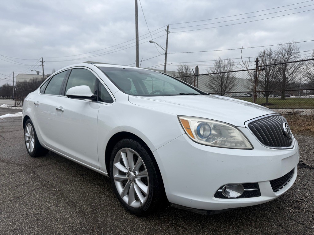 2012 Buick Verano Image 1