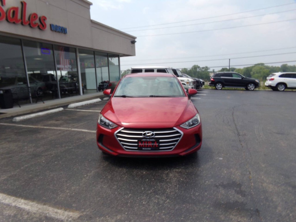2017 Hyundai Elantra Image 3