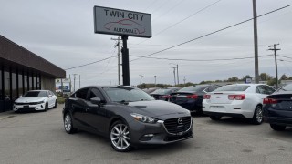 Image for 2017 Mazda Mazda3 Touring ID: 6959289