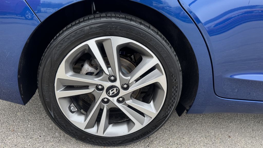 2017 Hyundai Elantra Image 10
